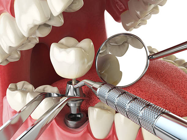 Best Emergency Denture Repair in Sterlington, LA